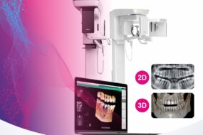 CBCT Αξονική Γνάθων